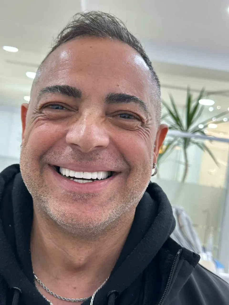 impianti dentali in Albania per pazienti italiani